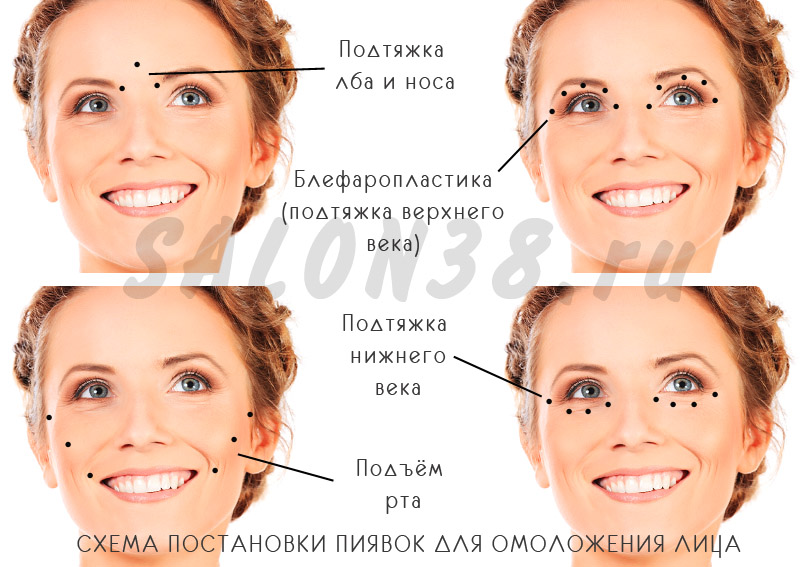СХЕМА ПОСТАНОВК� П� ЯВОК ДЛЯ ОМОЛОЖЕН� Я Л� ЦА в Петербурге